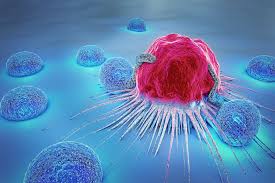 Cancer Lawsuit Awareness